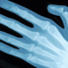 Scanner � rayons X